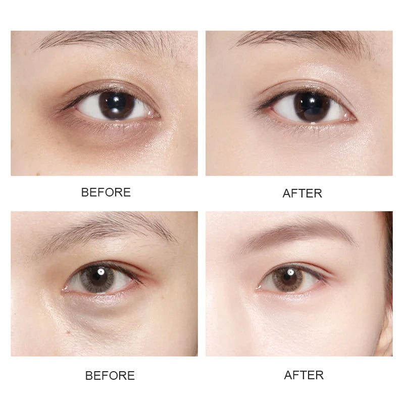 5/10/20/30 Pairs Crystal Gold Eye Patches Anti Dark Circles Remove Eye Bags Moisturizing Golden Collagen Eye Mask Skin Care Eyes